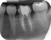 ortodonzia conservativa