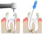 endodonzia a roma endodonzia a roma
