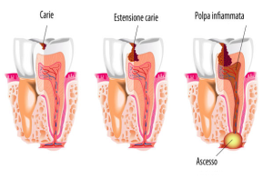 Nuove frontiere odontoiatriche – dentina
