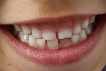 Pedodonzia-studiodentisticodbcalef.com