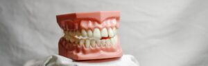 Occlusione mandibolare – intervista video
