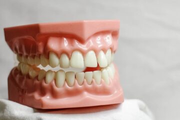 occlusione-dentale_studio-dentistico-d-b-calef-Roma-Balduina