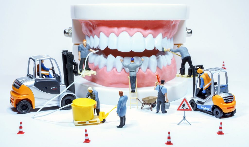 Protesi dentali_studio-dentistico-Calef-Roma